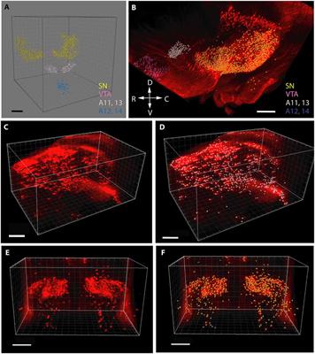 Gestational Exposure to Sodium Valproate Disrupts Fasciculation of the Mesotelencephalic Dopaminergic Tract, With a Selective Reduction of Dopaminergic Output From the Ventral Tegmental Area